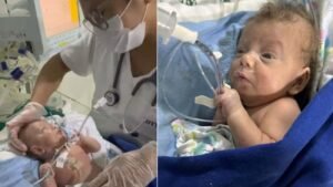 Bebê prematuro extremo recebe alta após seis meses em UTI no Amapá