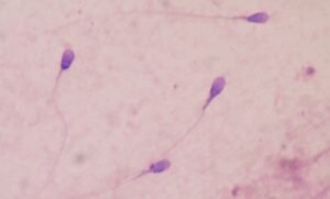 Microgravidade pode desorientar espermatozoides humanos; entenda fenômeno