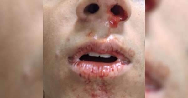 Policial Rodoviário agride crianças em condomínio no RN, veja o momento