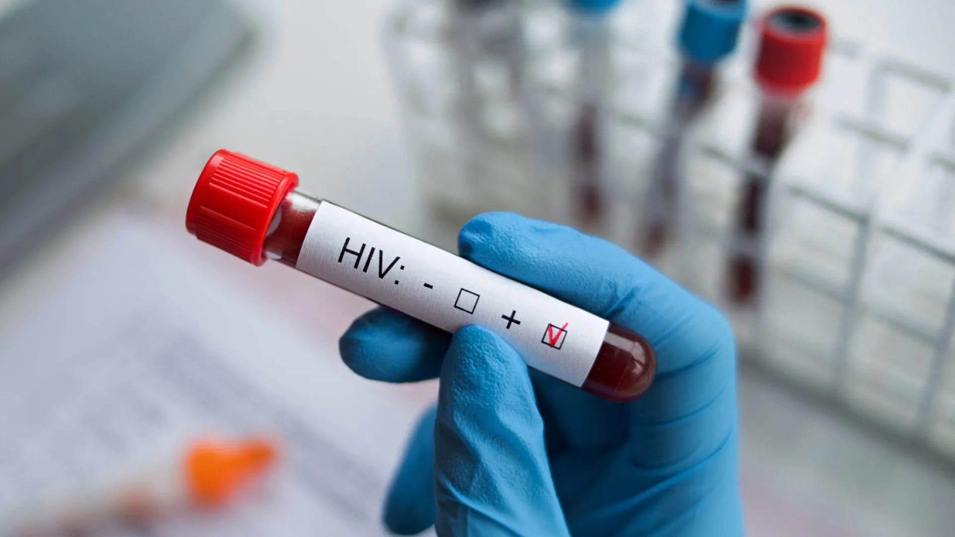 Cientistas desenvolvem nanopartículas de mRNA que podem levar à cura do HIV