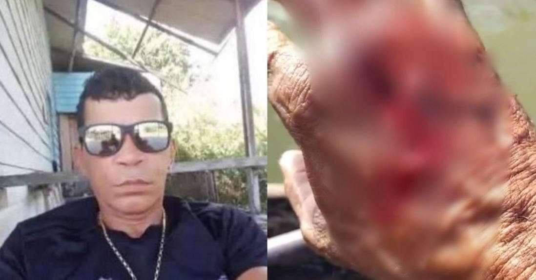 Pescador é atacado por jacaré durante pescaria no rio Tapajós, em Itaituba