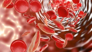 Sabe o que é anemia falciforme ou drepanocitose? Saiba os sintomas
