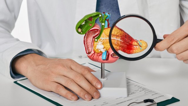 Estudo revela hábito que pode triplicar risco de câncer de pâncreas
