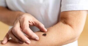 Tratamentos contra o câncer avançam com grandes promessas